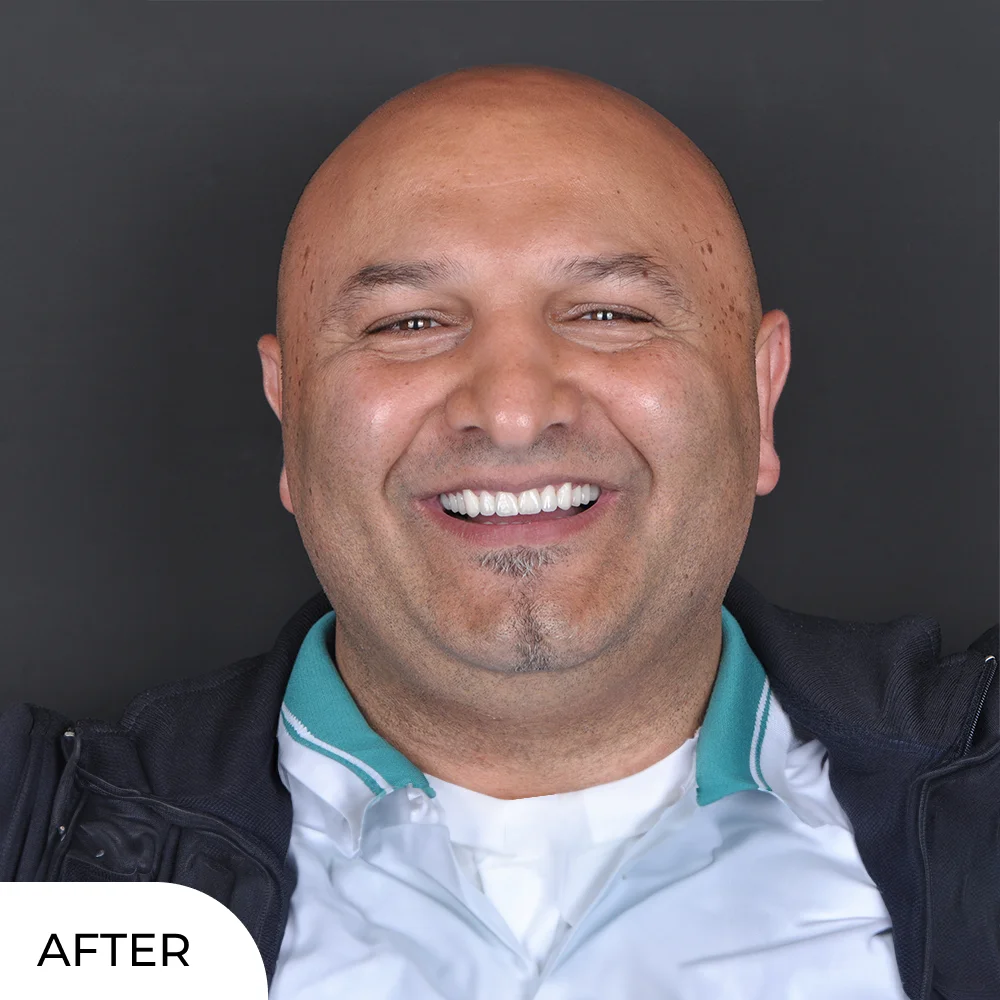 Dejan after aqua dental clinic