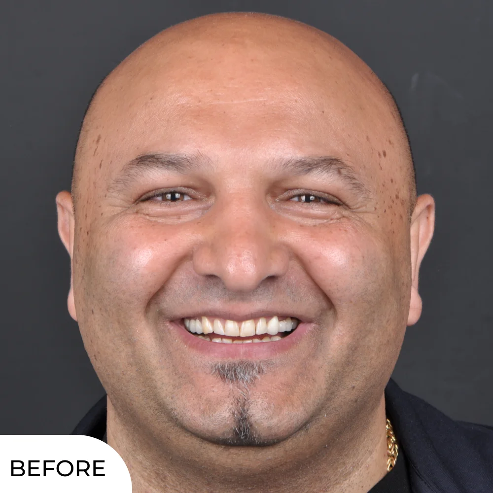 Dejan before aqua dental clinic