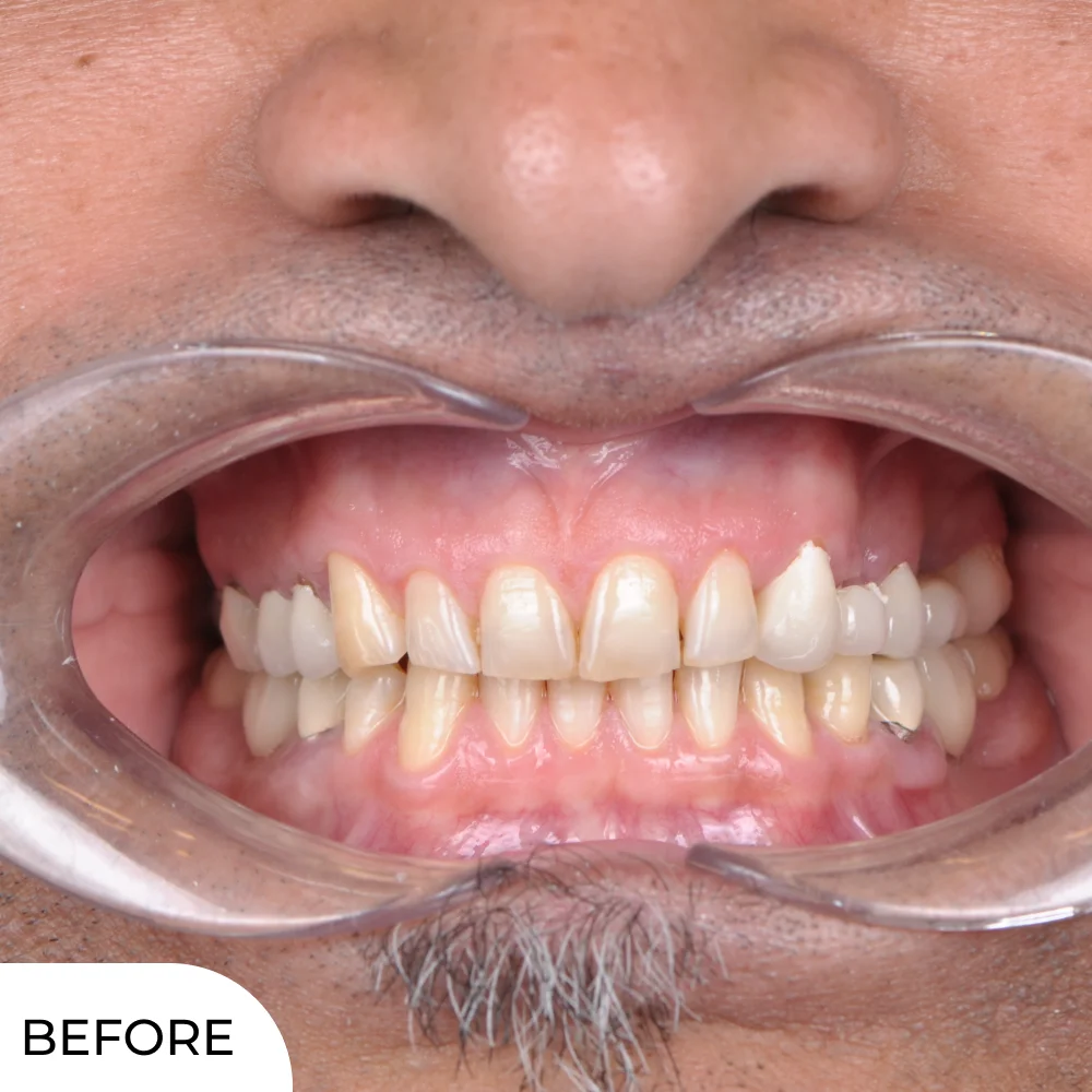 Dejan closeup before aqua dental clinic